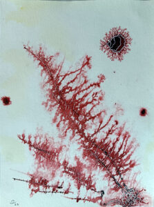 2025 Dendrites sang. Bloody dendrite.